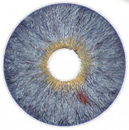 Abb. 3: Die künstlichen Augenlinsen von HumanOptics werden unter strengen Vorgaben des Qualitätsmanagementsystems produziert.