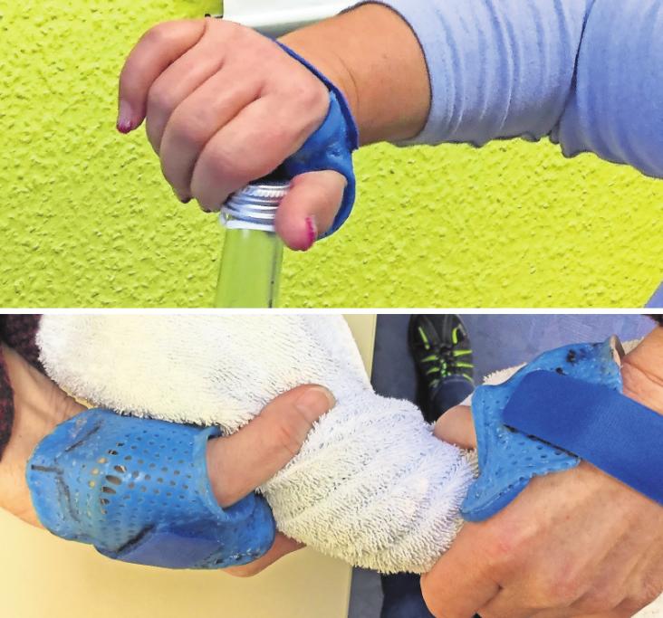 Ob beim Flasche öffnen oder Tuch auswringen: Mit der Orthese haben die Patienten wieder einen schmerzfreien Alltag. Fotos: MSB Ob beim Flasche öffnen oder Tuch auswringen: Mit der Orthese haben die Patienten wieder einen schmerzfreien Alltag. Fotos: MSB