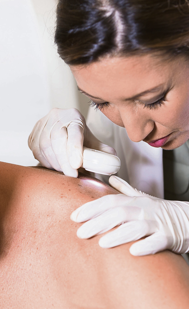 Hautkrebsscreening ist eine Erfahrungssache. Der Arzt oder die Ärztin lernen während eines ganzen Berufslebens immer mehr dazu. Sie begutachten die Haut mit einem Dermatoskop, einer Speziallupe, die einer starke Lichtquelle besitzt.
