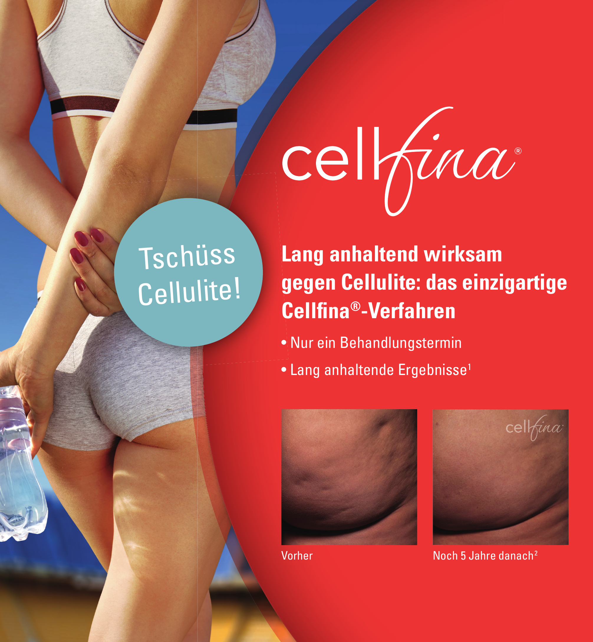 Cellfina® Cellfina®