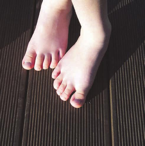 Angenehm zu nackten Füßen: Aufgrund der Thermobehandlung sind Splitter auf den Terrassendielen so gut wie ausgeschlossen. Foto: djd/swero.de Angenehm zu nackten Füßen: Aufgrund der Thermobehandlung sind Splitter auf den Terrassendielen so gut wie ausgeschlossen. Foto: djd/swero.de