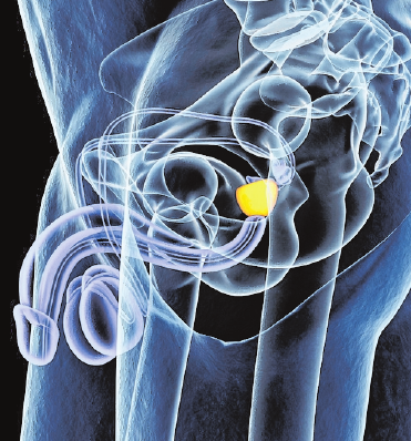 Die Prostata liegt unter der Harnblase und umschließt die Harnröhre wie ein Ring. FOTO: GETTY IMAGES Die Prostata liegt unter der Harnblase und umschließt die Harnröhre wie ein Ring. FOTO: GETTY IMAGES