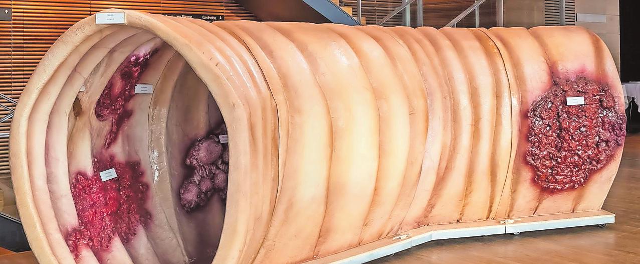 Sieben Meter lang ist das Modell eines Darms. FOTO: VERANSTALTER Sieben Meter lang ist das Modell eines Darms. FOTO: VERANSTALTER
