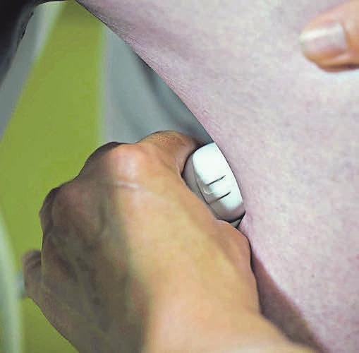 Die neue TVT-Diagnose an durch Thrombosen gefährdeten Beinen ist einfach handhabbar. FOTOS:THINK-SONO Die neue TVT-Diagnose an durch Thrombosen gefährdeten Beinen ist einfach handhabbar. FOTOS:THINK-SONO