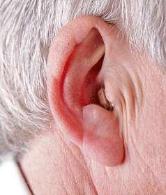 Kaum zu sehen: ein sogenanntes Im-Ohr-Hörgerät