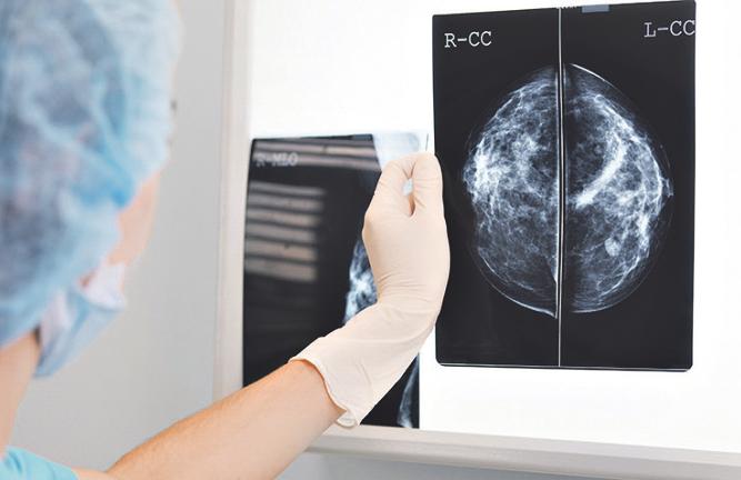 Ergebnisse einer Mammographie. Fotos: adobe stock.com/PhotoPlus+ Ergebnisse einer Mammographie. Fotos: adobe stock.com/PhotoPlus+