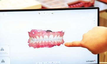 Der intraorale 3D-Scan ermöglicht es dem Patienten, sein Gebiss von allen Seiten auf dem Bildschirm zu betrachten