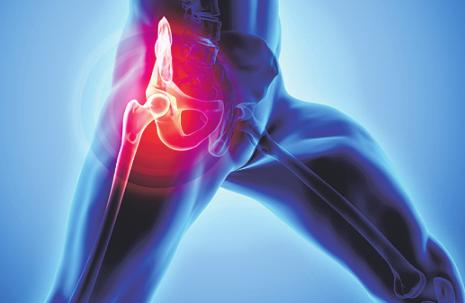 An komplexen Bewegungen beteiligt: der Musculus iliopsoas. Foto: yodiyim/ stock.adobe.com An komplexen Bewegungen beteiligt: der Musculus iliopsoas. Foto: yodiyim/ stock.adobe.com