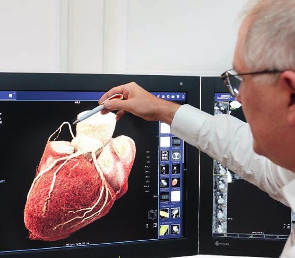 Die Herzdiagnostik gehört zu den großen Schwerpunkten der Radiologie am Rathausmarkt